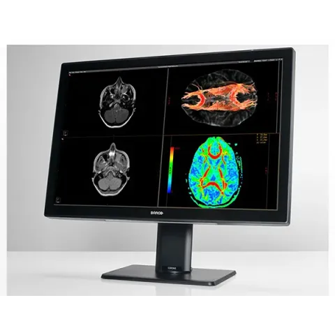 Barco Coronis Fusion 6MP Medikal Teşhis Monitörü