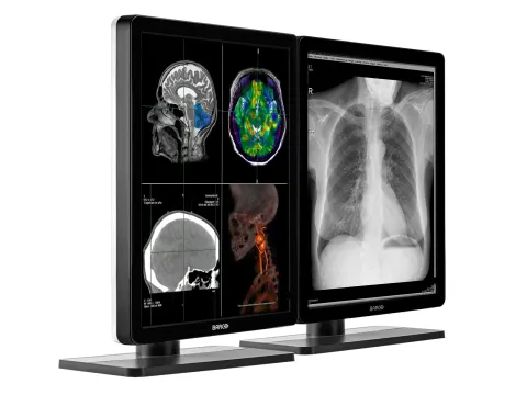 Barco Nio Color 2MP (MDNC-2221) Medikal Monitör
